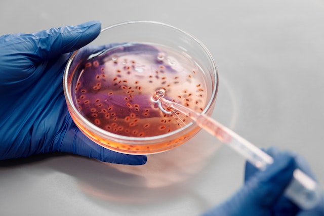 Person dropping liquid into a red petri dish full of bacteria, some which can cause the diseases roaches carry